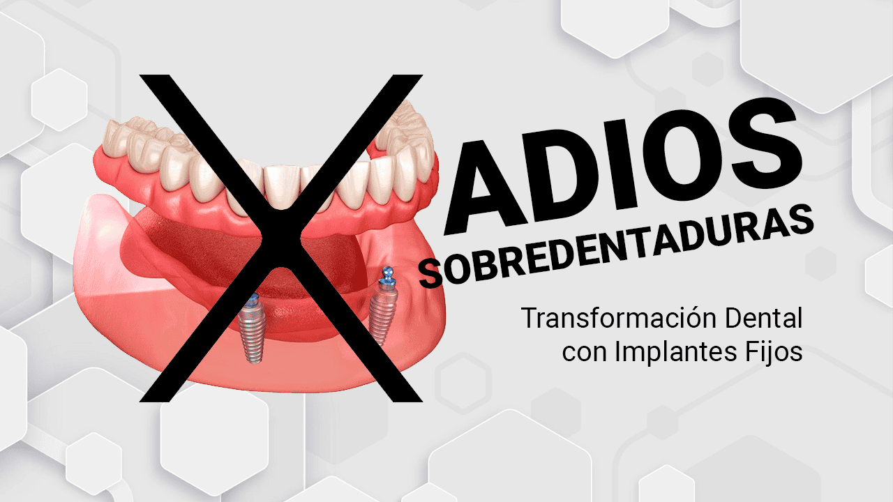 Caso 3